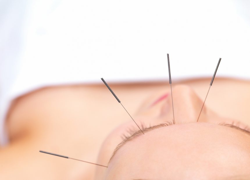 Tratamento de ansiedade com acupuntura