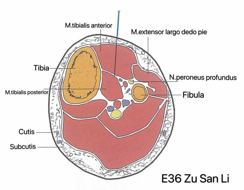 Inserção do E36 acupuntura