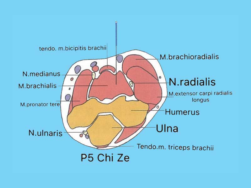 Profundidade de inserção da agulha no P5 - Chize