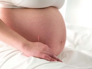 contra indicações da acupuntura na gravidez