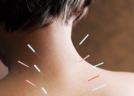 acupuntura sistêmica