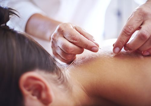 O que fazer durante a consulta de acupuntura