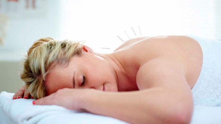 Acupuntura Saude