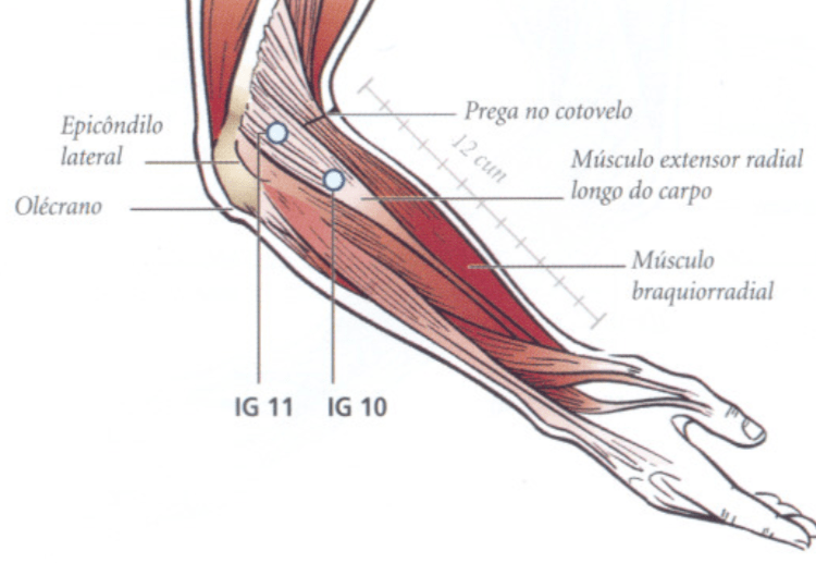 IG11 acupuntura