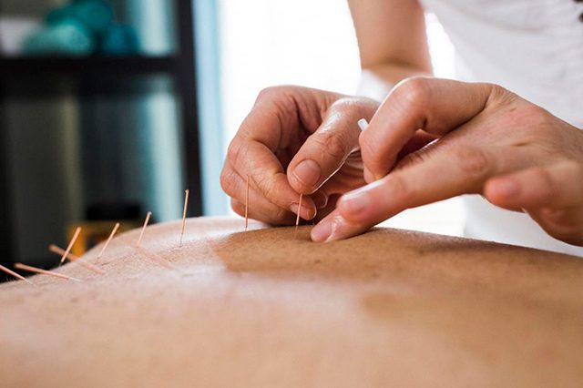 tratamento acupuntura na praca da arvore