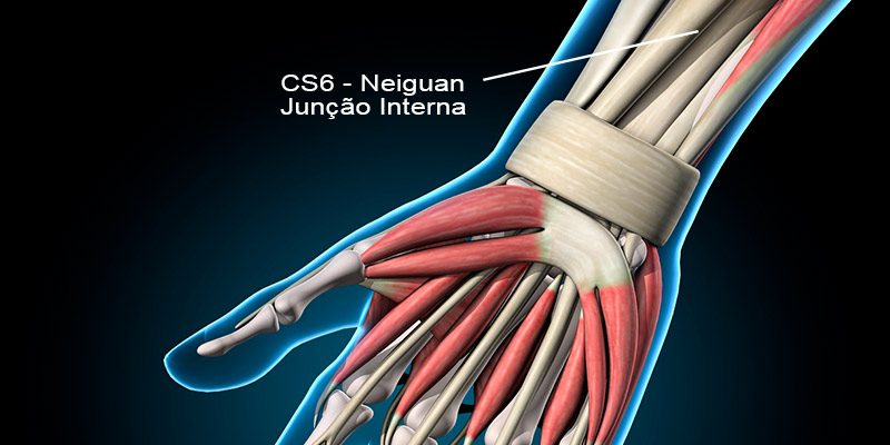 CS6 acupuntura