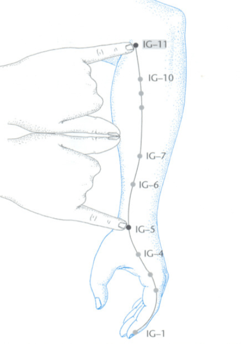 IG11 acupuntura
