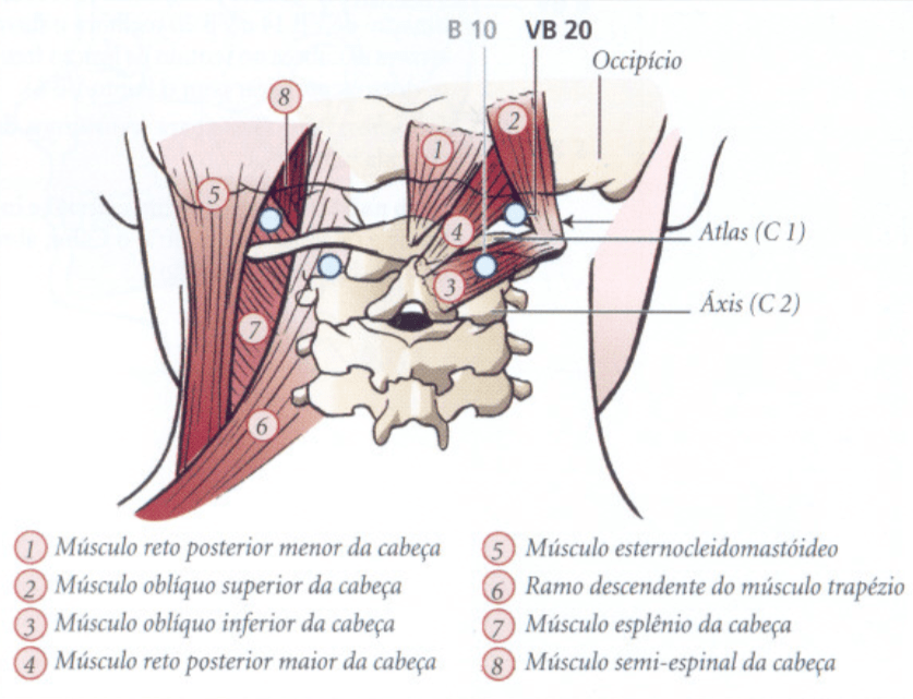 VB20 acupuntura