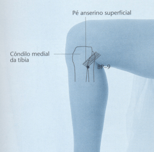 BP9 Acupuntura Cláudia Focks como localizar