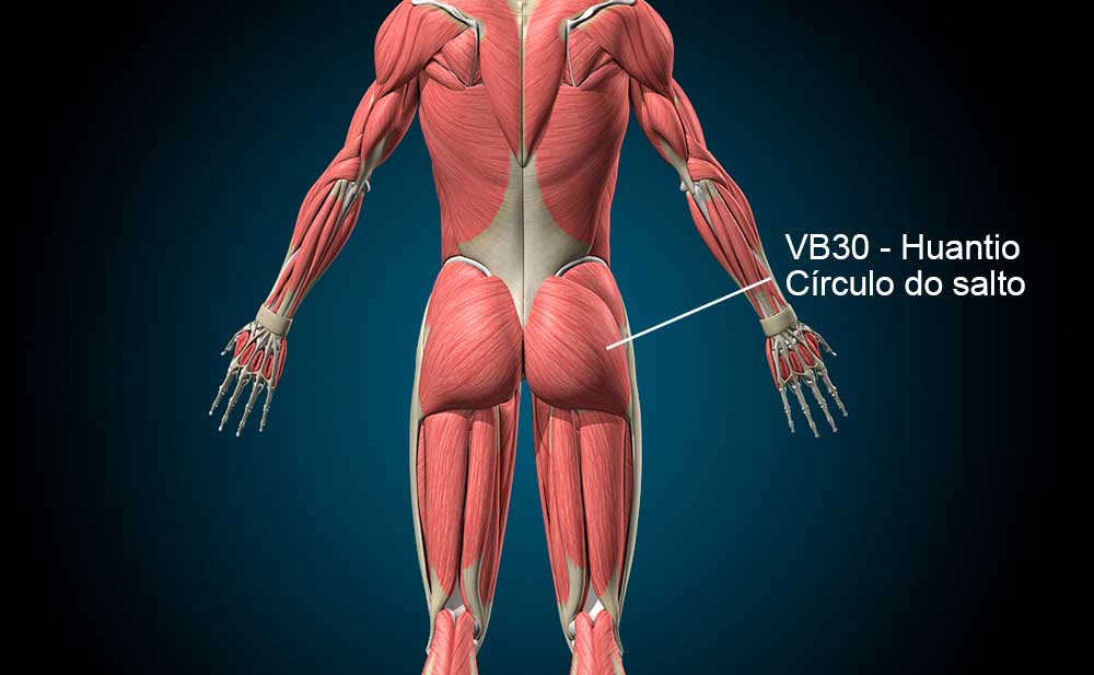 VB30 acupuntura