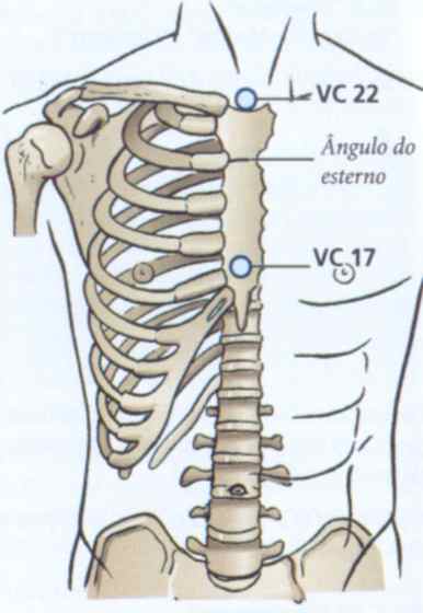 vc17 acupuntura localização