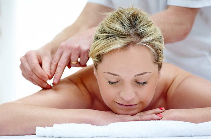 Acupuntura preventiva como tratamento preventivo