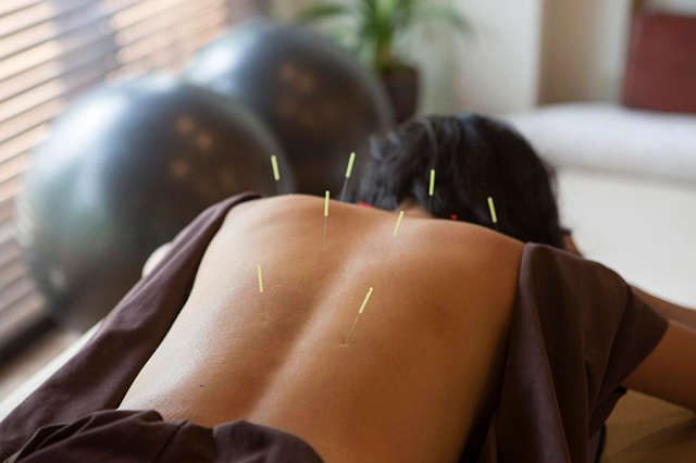 a acupuntura pode doer
