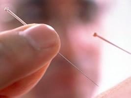 Acupuntura o qi e suas funções