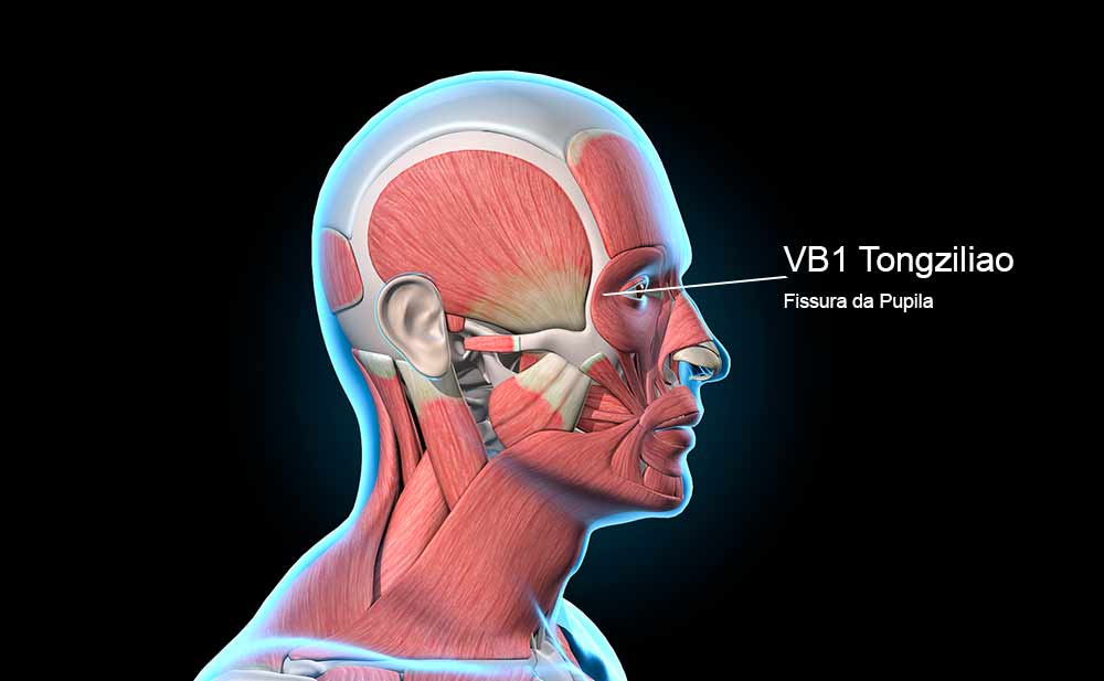 VB1 acupuntura